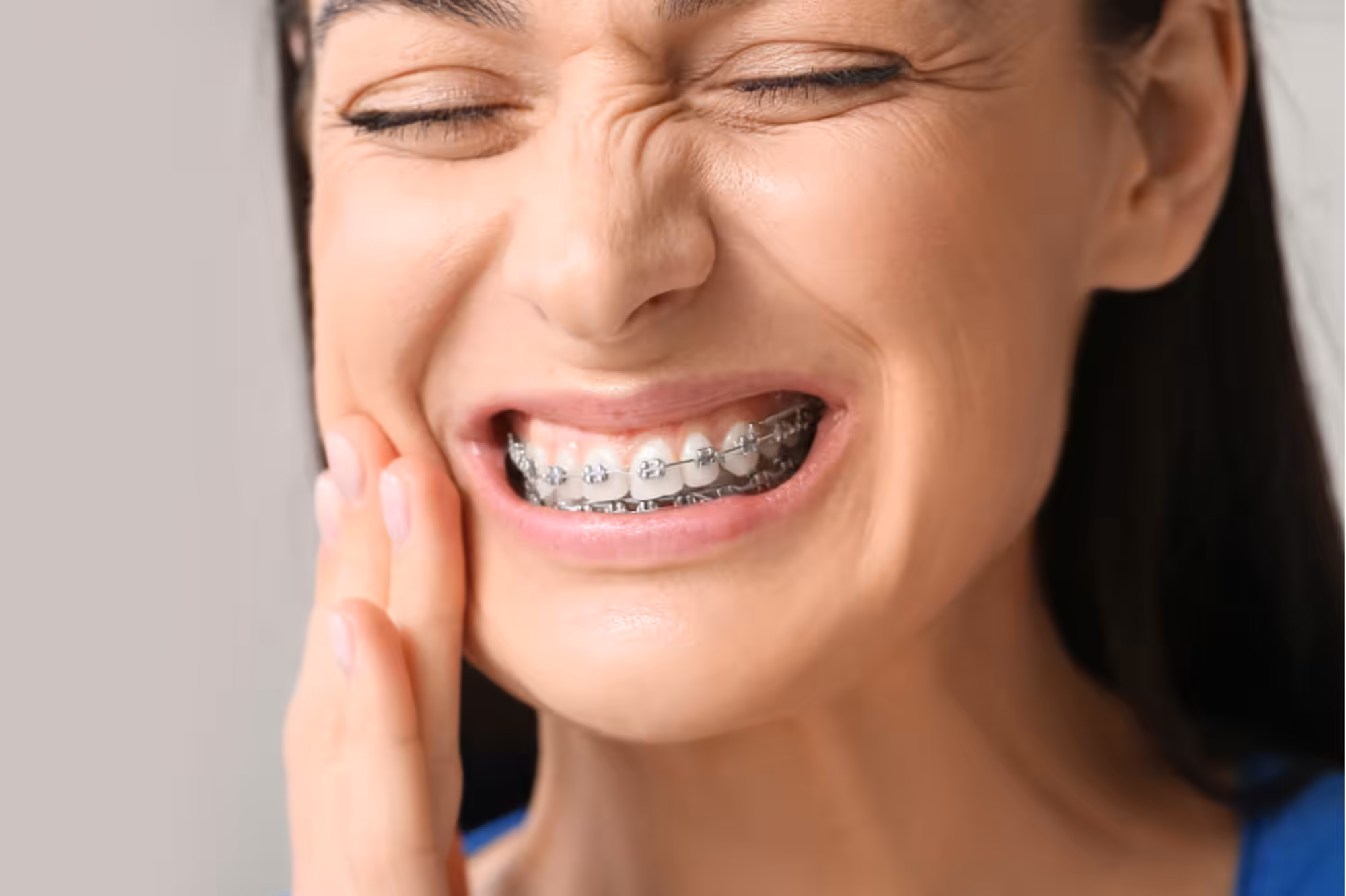0824 Does It Hurt to Get Braces Put On 4 0824 Does It Hurt to Get Braces Put On 4
